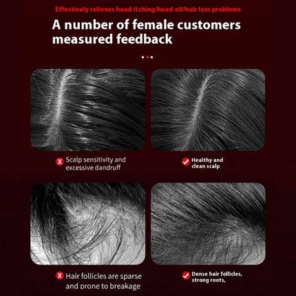 Electric Vibration Massage Comb Portable Hair Follicle Comb